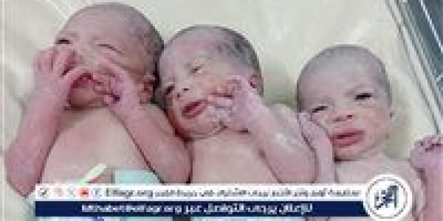 "أبو قرقاص المركزي" تنجح بإجراء عملية قيصرية لسيدة حامل بتوائم ثلاثة ذكور